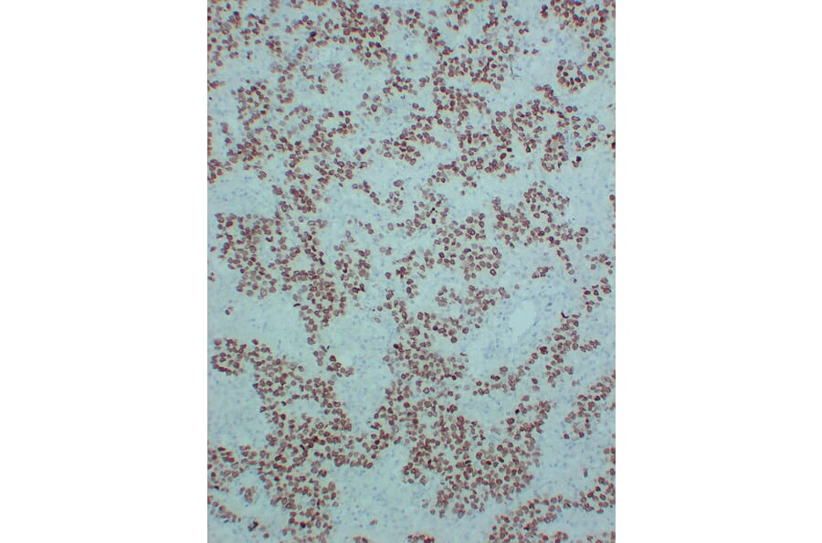 Immunohistochemistry - Anti-SALL4 Antibody (V0147) - Antibodies.com