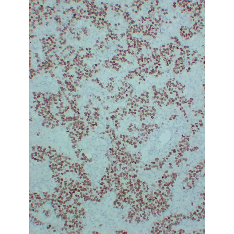 Immunohistochemistry - Anti-SALL4 Antibody (V0147) - Antibodies.com