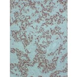 Immunohistochemistry - Anti-SALL4 Antibody (V0147) - Antibodies.com