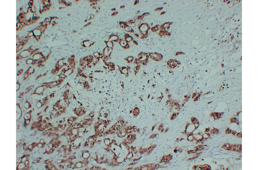 Immunohistochemistry - Anti-S100P Antibody (V0124) - Antibodies.com