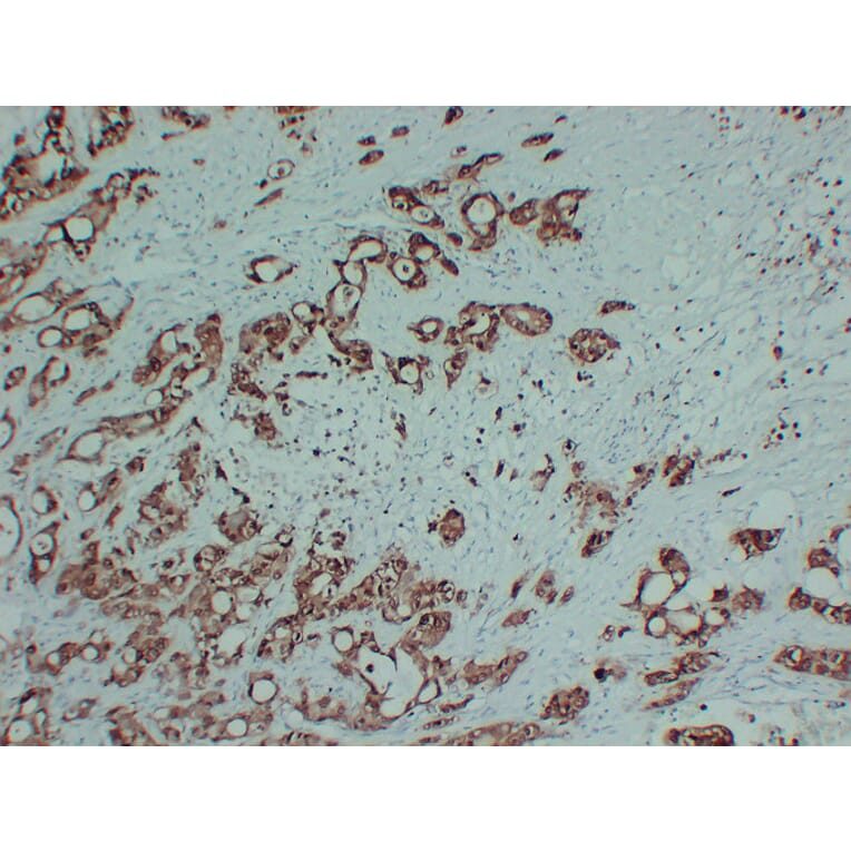 Immunohistochemistry - Anti-S100P Antibody (V0124) - Antibodies.com