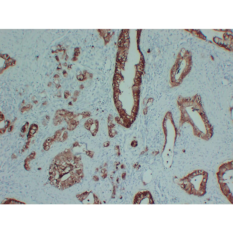 Immunohistochemistry - Anti-S100P Antibody (V0124) - Antibodies.com