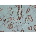 Immunohistochemistry - Anti-S100P Antibody (V0124) - Antibodies.com
