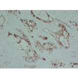 Immunohistochemistry - Anti-S100P Antibody (V0124) - Antibodies.com