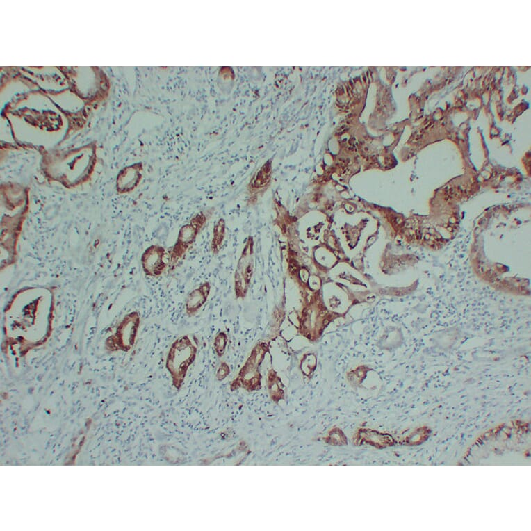 Immunohistochemistry - Anti-S100P Antibody (V0124) - Antibodies.com