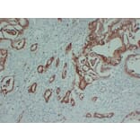 Immunohistochemistry - Anti-S100P Antibody (V0124) - Antibodies.com