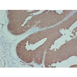 Immunohistochemistry - Anti-S100P Antibody (V0124) - Antibodies.com