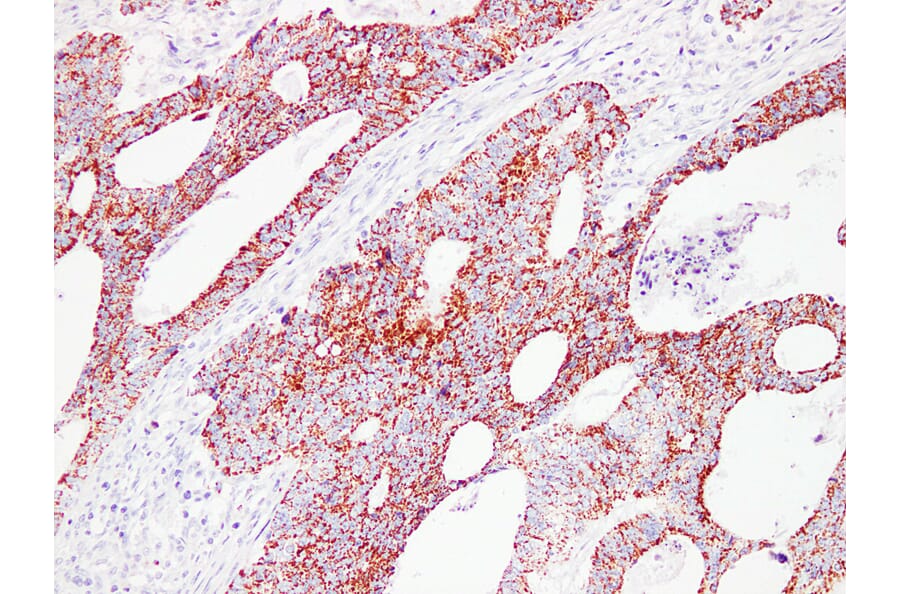 Immunohistochemistry - Anti-HSP60 Antibody (V0084) - Antibodies.com