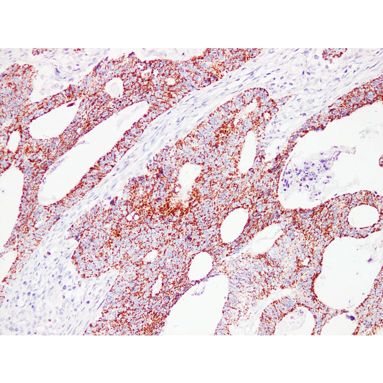 Immunohistochemistry - Anti-HSP60 Antibody (V0084) - Antibodies.com