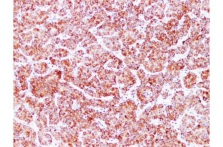 Immunohistochemistry - Anti-HSP60 Antibody (V0084) - Antibodies.com