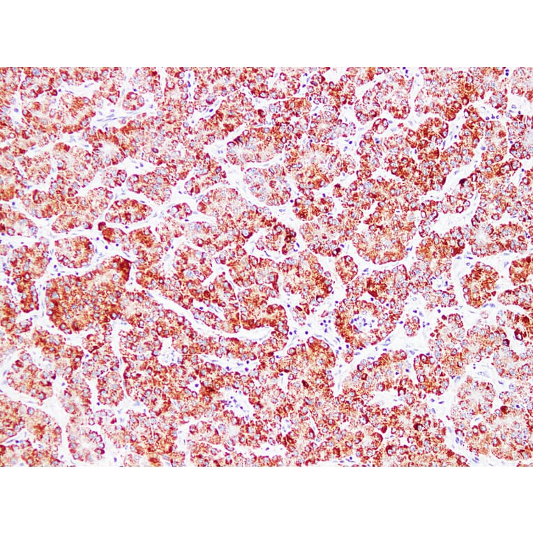 Immunohistochemistry - Anti-HSP60 Antibody (V0084) - Antibodies.com