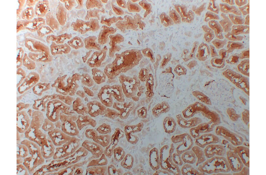 Immunohistochemistry - Anti-HDAC6 Antibody (V0082) - Antibodies.com