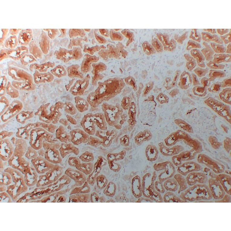 Immunohistochemistry - Anti-HDAC6 Antibody (V0082) - Antibodies.com