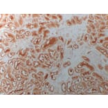 Immunohistochemistry - Anti-HDAC6 Antibody (V0082) - Antibodies.com