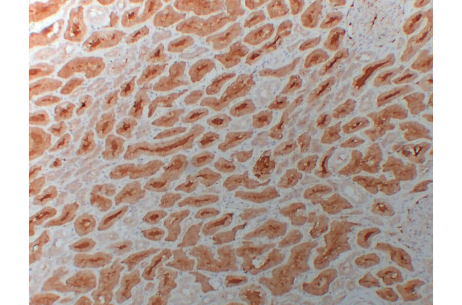 Immunohistochemistry - Anti-HDAC6 Antibody (V0082) - Antibodies.com