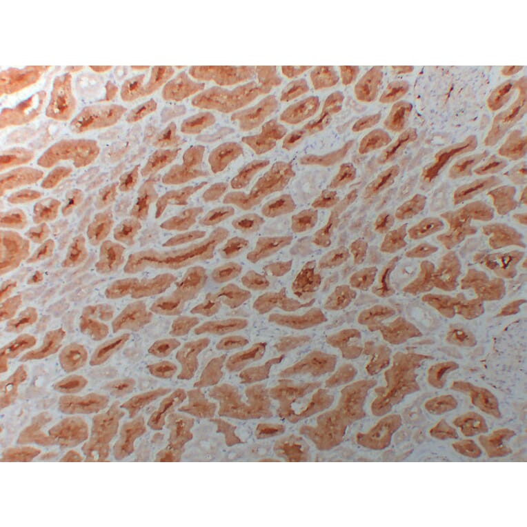 Immunohistochemistry - Anti-HDAC6 Antibody (V0082) - Antibodies.com