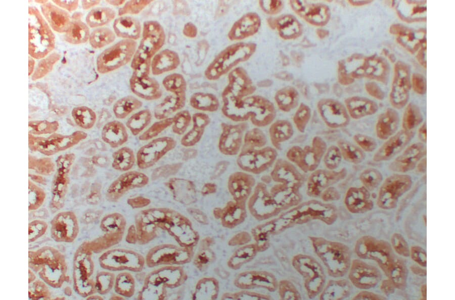 Immunohistochemistry - Anti-HDAC6 Antibody (V0082) - Antibodies.com