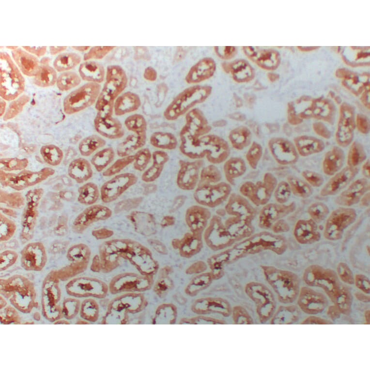 Immunohistochemistry - Anti-HDAC6 Antibody (V0082) - Antibodies.com