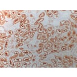 Immunohistochemistry - Anti-HDAC6 Antibody (V0082) - Antibodies.com