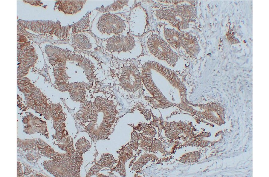 Immunohistochemistry - Anti-EpCAM Antibody (V0068) - Antibodies.com