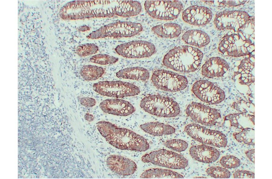 Immunohistochemistry - Anti-EpCAM Antibody (V0068) - Antibodies.com