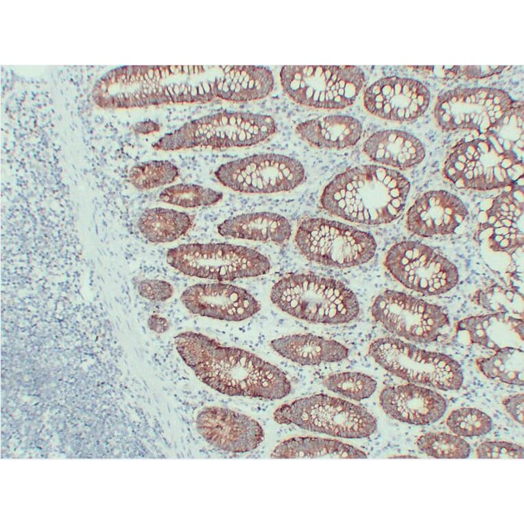 Immunohistochemistry - Anti-EpCAM Antibody (V0068) - Antibodies.com