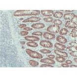 Immunohistochemistry - Anti-EpCAM Antibody (V0068) - Antibodies.com