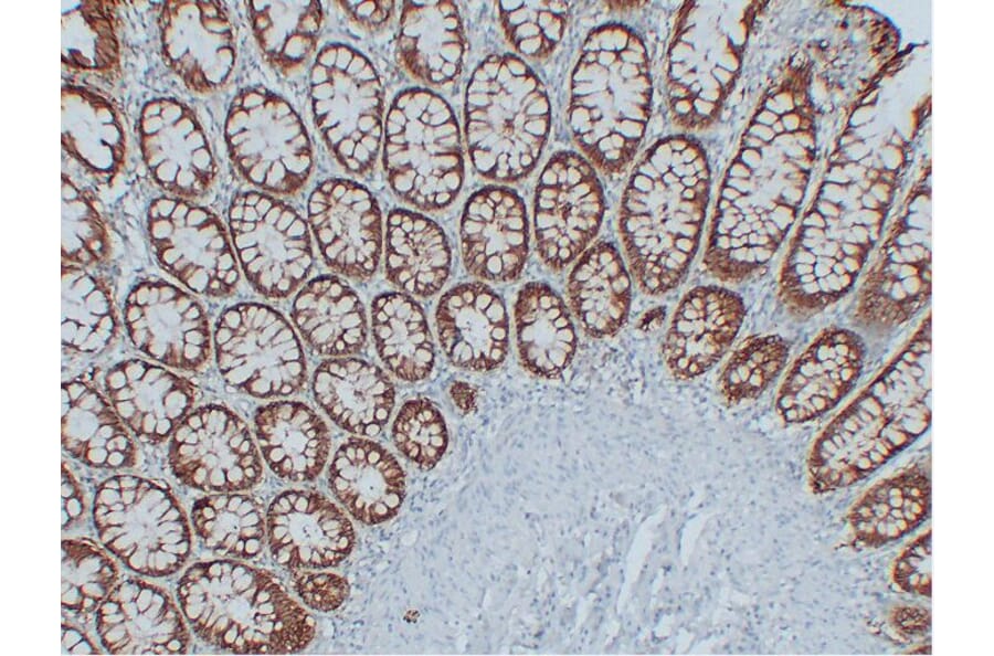 Immunohistochemistry - Anti-EpCAM Antibody (V0068) - Antibodies.com