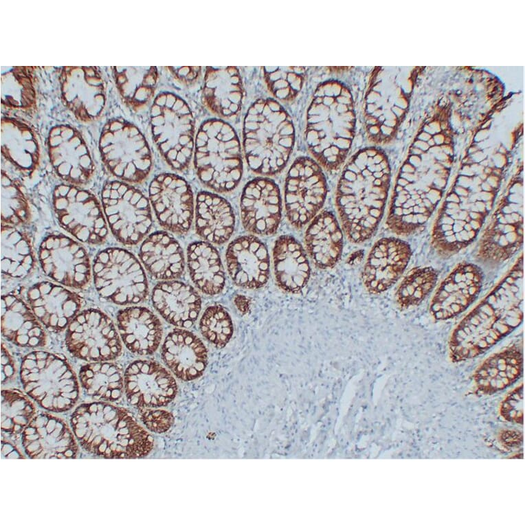 Immunohistochemistry - Anti-EpCAM Antibody (V0068) - Antibodies.com
