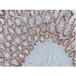 Immunohistochemistry - Anti-EpCAM Antibody (V0068) - Antibodies.com