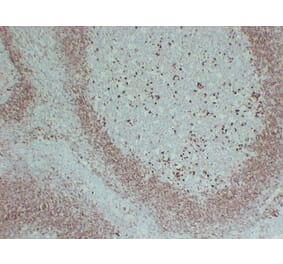 Immunohistochemistry - Anti-CD79a Antibody (V0038) - Antibodies.com