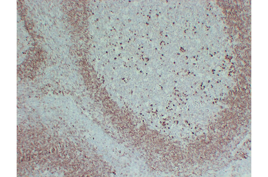 Immunohistochemistry - Anti-CD79a Antibody (V0038) - Antibodies.com