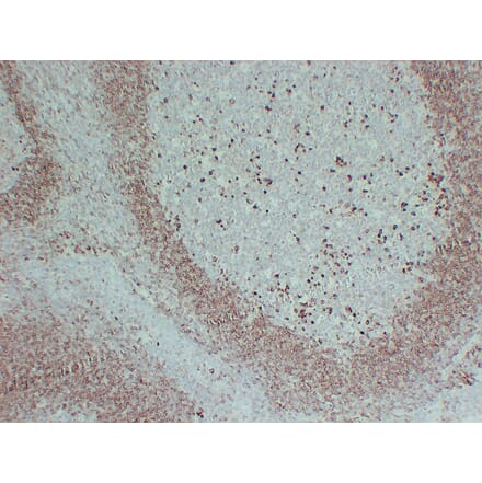 Immunohistochemistry - Anti-CD79a Antibody (V0038) - Antibodies.com