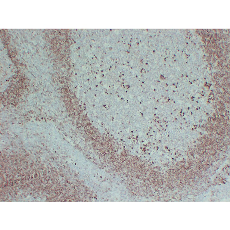 Immunohistochemistry - Anti-CD79a Antibody (V0038) - Antibodies.com