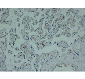Immunohistochemistry - Anti-CD163 Antibody (V0017) - Antibodies.com