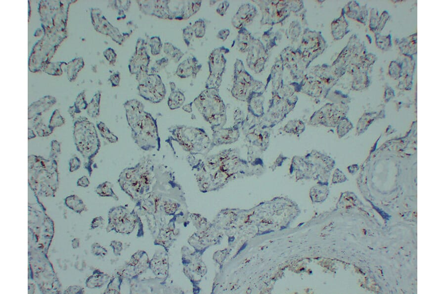 Immunohistochemistry - Anti-CD163 Antibody (V0017) - Antibodies.com