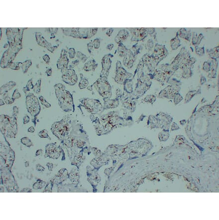 Immunohistochemistry - Anti-CD163 Antibody (V0017) - Antibodies.com