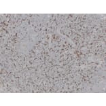 Immunohistochemistry - Anti-CD163 Antibody (V0017) - Antibodies.com