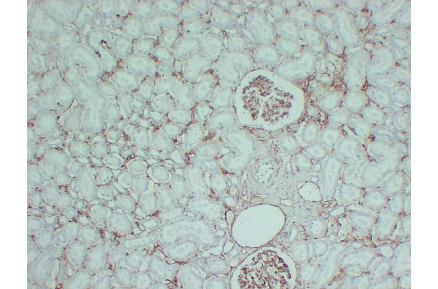 Immunohistochemistry - Anti-CD105 Antibody (V0015) - Antibodies.com