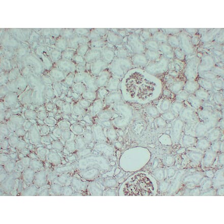 Immunohistochemistry - Anti-CD105 Antibody (V0015) - Antibodies.com