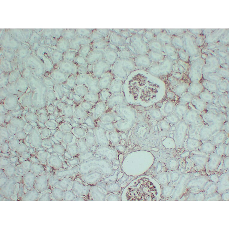 Immunohistochemistry - Anti-CD105 Antibody (V0015) - Antibodies.com