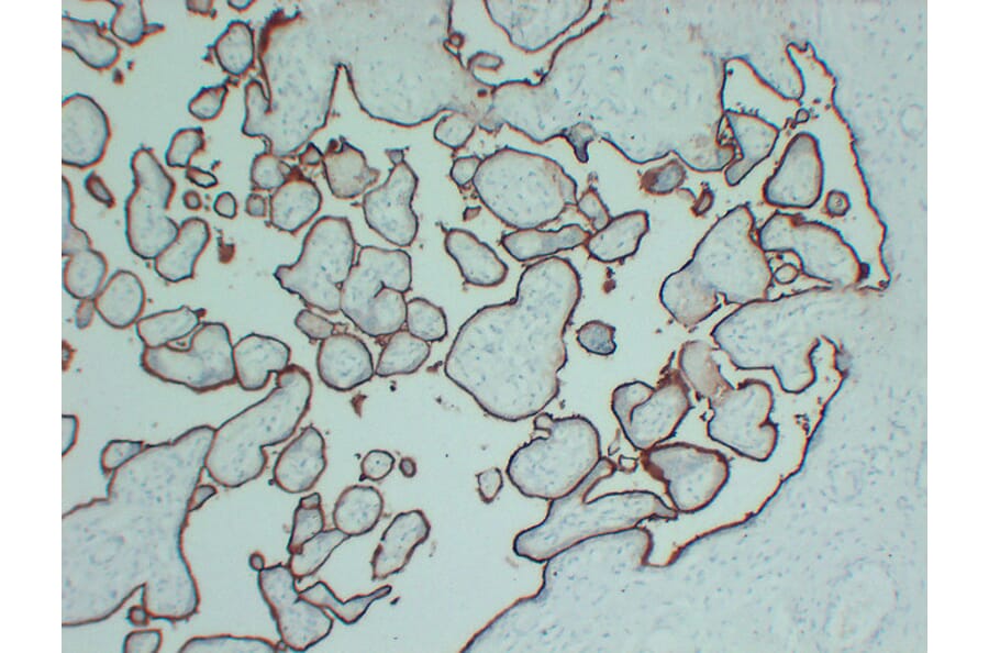 Immunohistochemistry - Anti-CD105 Antibody (V0015) - Antibodies.com