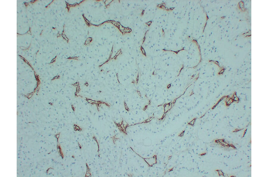 Immunohistochemistry - Anti-CD105 Antibody (V0015) - Antibodies.com