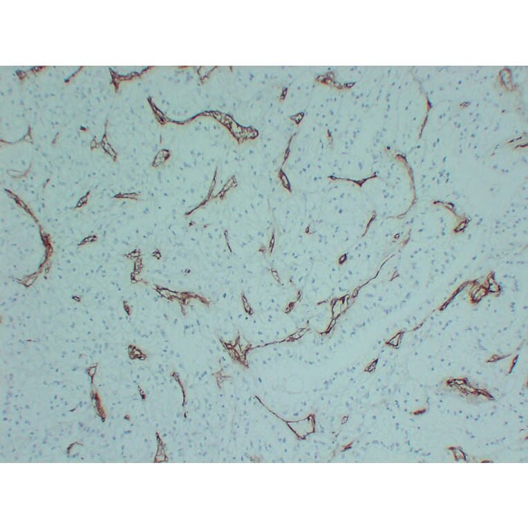 Immunohistochemistry - Anti-CD105 Antibody (V0015) - Antibodies.com