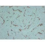 Immunohistochemistry - Anti-CD105 Antibody (V0015) - Antibodies.com