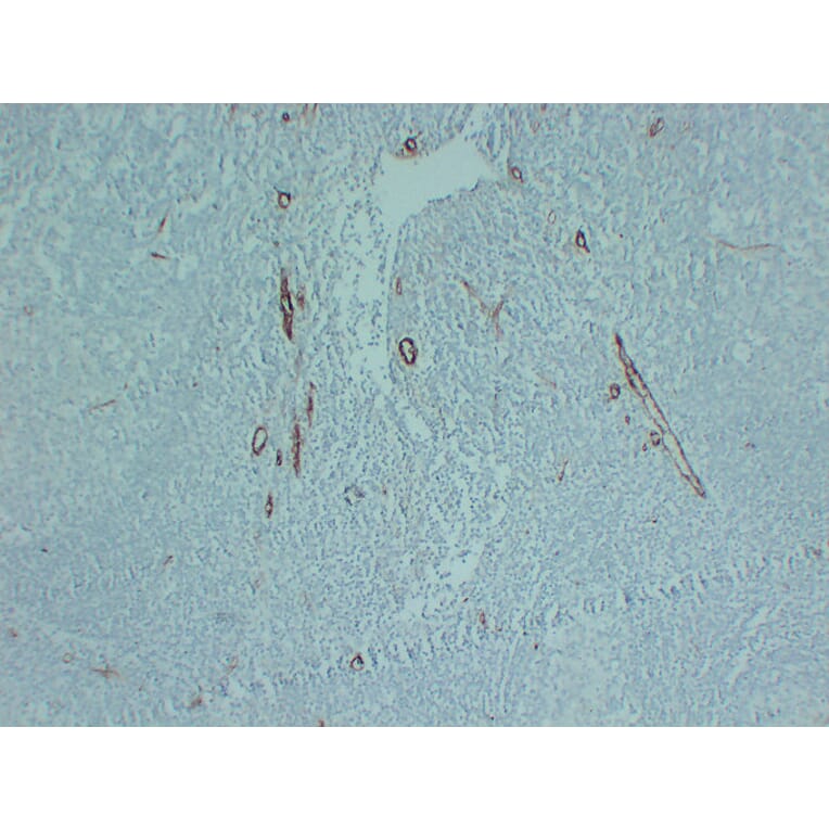 Immunohistochemistry - Anti-CD105 Antibody (V0015) - Antibodies.com