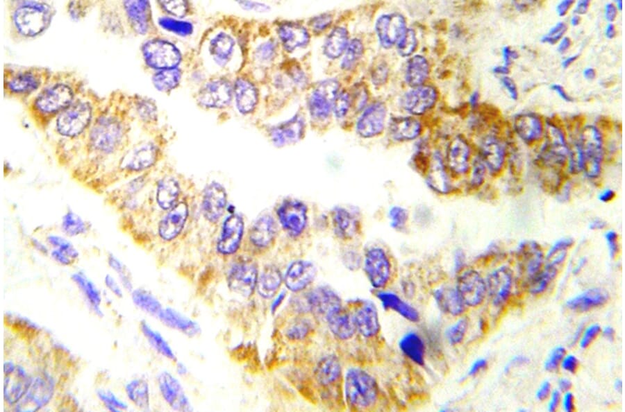 Immunohistochemistry - Anti-Tsc2 Antibody (R12-2396) - Antibodies.com