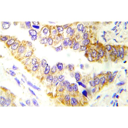 Immunohistochemistry - Anti-Tsc2 Antibody (R12-2396) - Antibodies.com