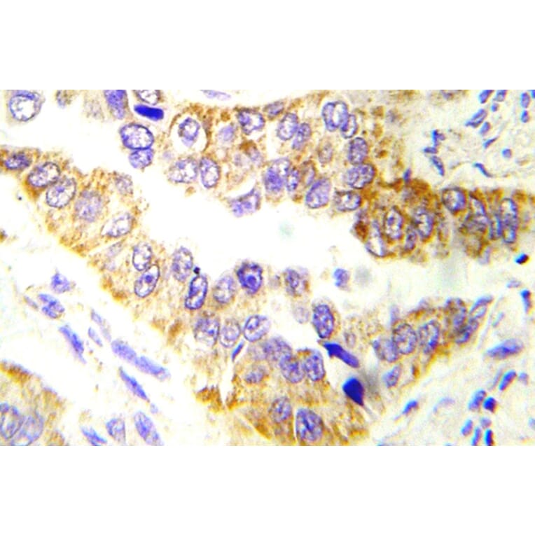 Immunohistochemistry - Anti-Tsc2 Antibody (R12-2396) - Antibodies.com