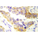 Immunohistochemistry - Anti-Tsc2 Antibody (R12-2396) - Antibodies.com
